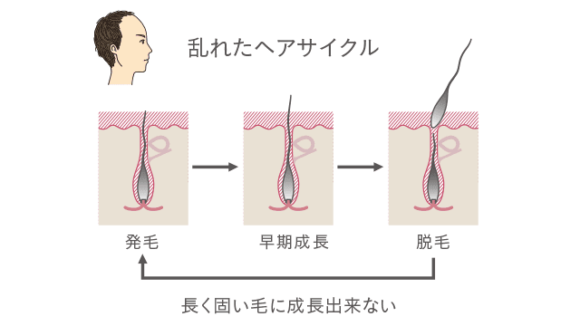 髪の成長とヘアサイクル Vitabridc12 Hair