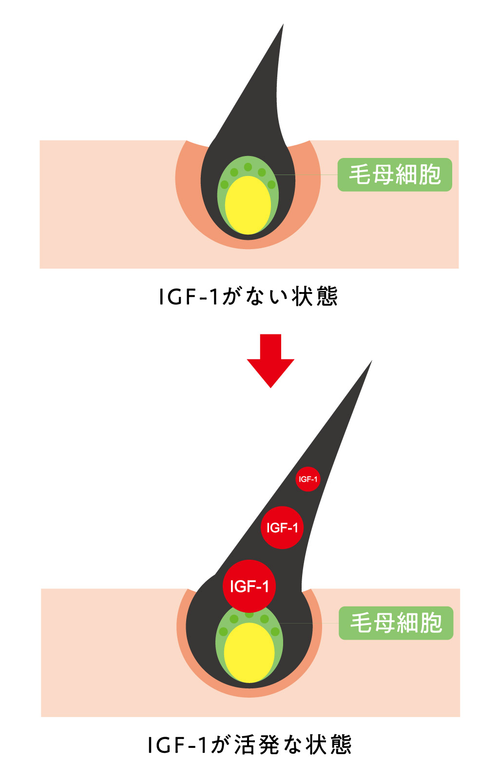 毛髪診断士 食生活の改善で 発毛効果倍増 Vitabridc12 Hair