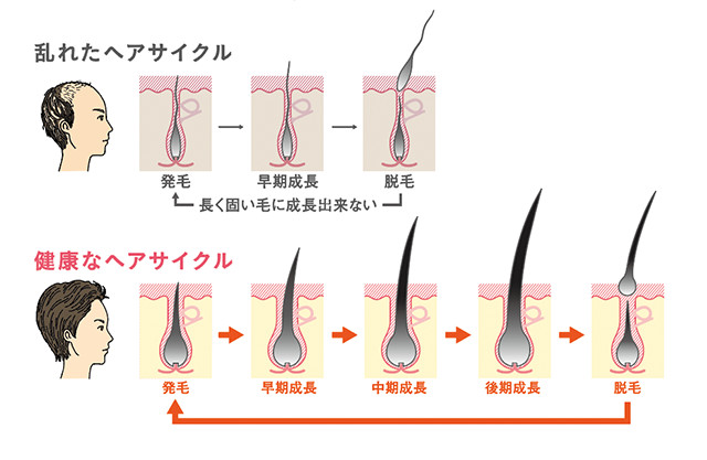 ハリ ツヤ低下 元気な髪を取り戻す 発毛促進 ケアとは 美容と健康とビタミンc