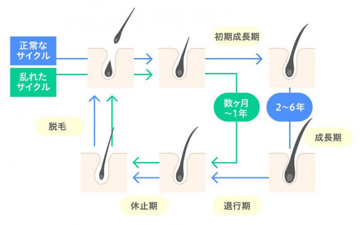 医師監修 抜け毛予防シャンプーで抜け毛本数は減る 選び方やおすすめは 美容と健康とビタミンc