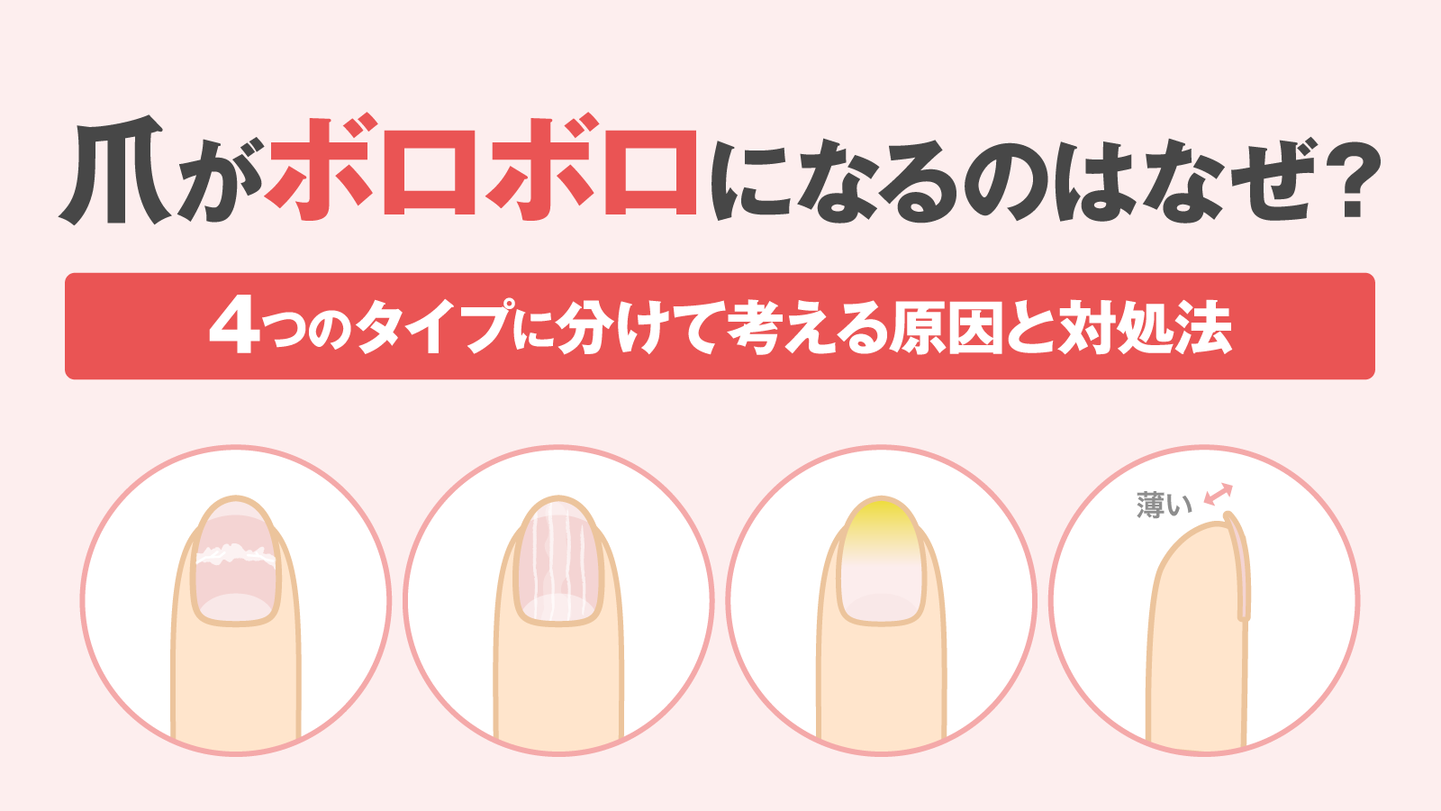 爪 が 弱い