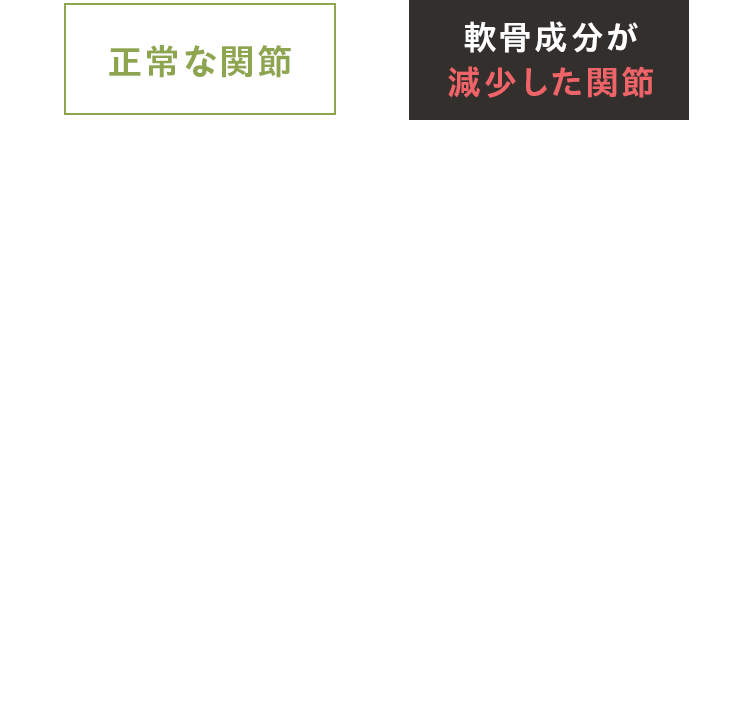 正常な関節 軟骨成分が減少した関節